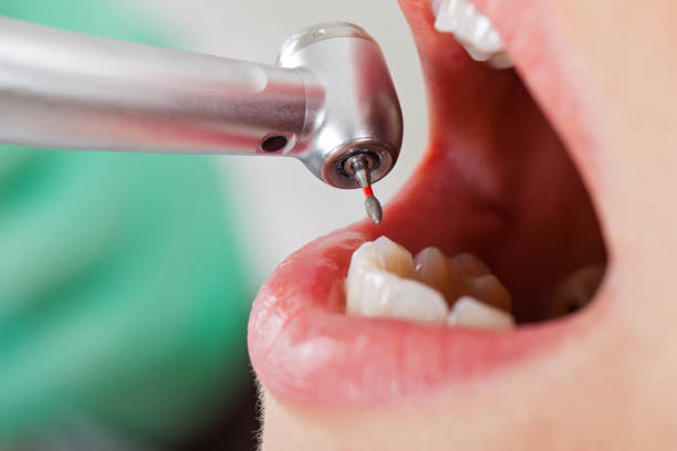 Best Pediatric Emergency Dentist in Stratford, TX
